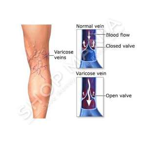 MERJA - CAJ PER VARICET "100% BIO" - 220G